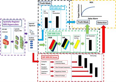 Assessing and testing anomaly detection for finding prostate cancer in spatially registered multi-parametric MRI